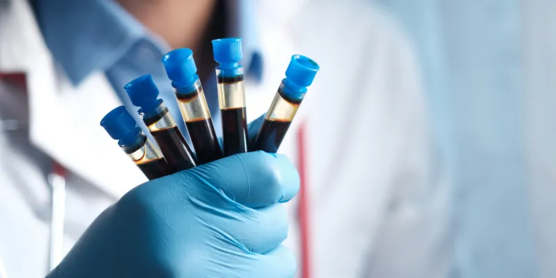 kiểm tra doping là gì
